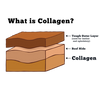 RedBarn Collagen Ring